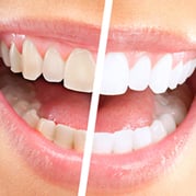 Cosmetic Dentistry