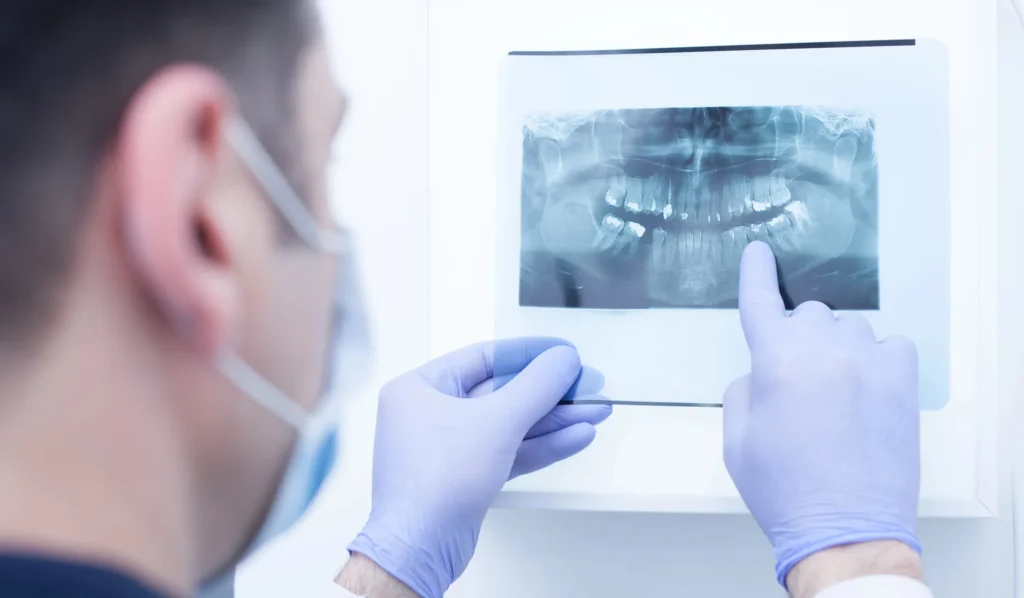 general dentist in Cary looking at a dental x-ray