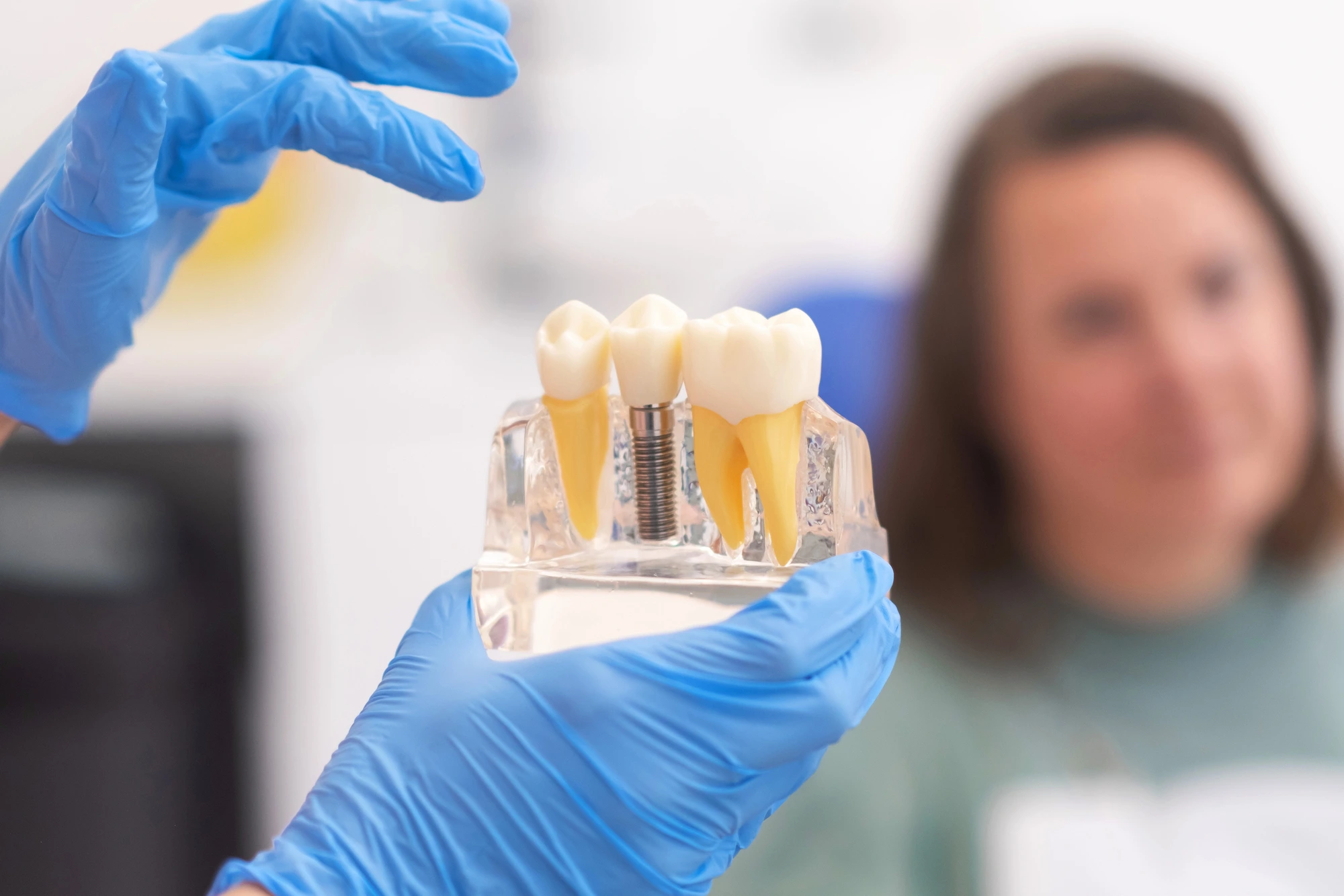 dentist-showing-patient-a-model-of-dental-implants-in-Cary